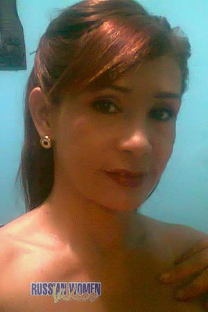 153461 - Grace Age: 50 - Colombia